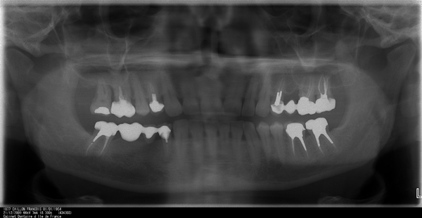 panoramique dentaire 29 12 2009.JPG